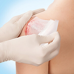 Leukoplast® Cuticell® Contact